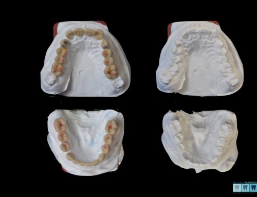 CERATURA GNATOLOGICA